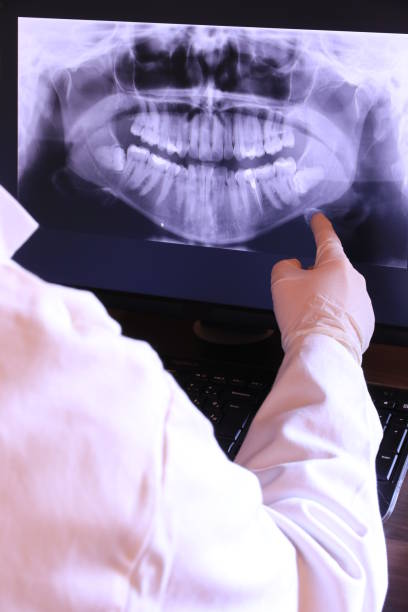 Emergency Dental Filling Replacement in NC